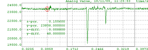 zoom_chart_x