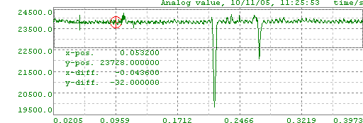 zoom_chart_y